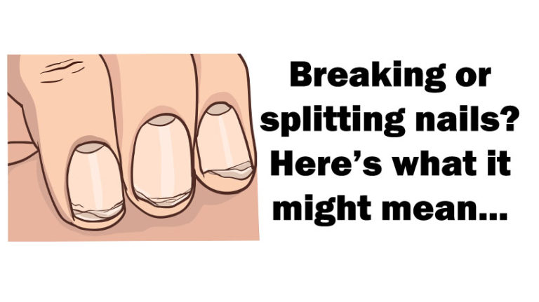 brittle-nails-what-that-might-mean-to-the-body-womenworking