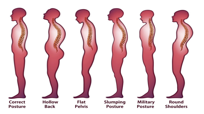 5-exercises-to-fix-hunchback-posture-and-stop-slouching-womenworking