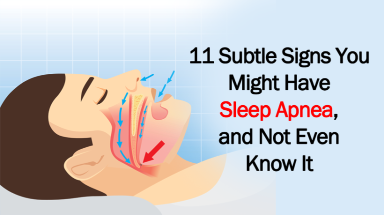 11 Subtle Signs You Might Have Sleep Apnea And Not Even Know It Womenworking 8485