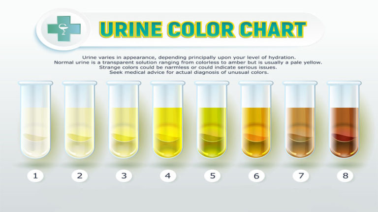 What Urine Color Says About A Persons Health Womenworking 6942