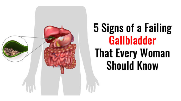 Gallbladder WomenWorking   Gallbladder 768x431 