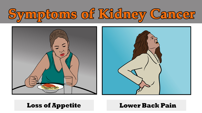 Kidney Cancer Symptoms Warning Signs