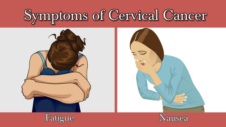 5-symptoms-of-cervical-cancer-womenworking