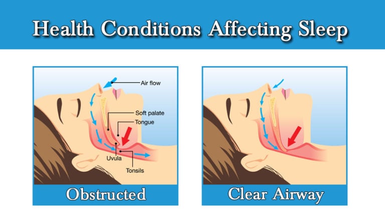 Struggling To Fall Asleep? Signs It Could Be One Of These Health 