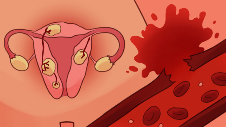 6-times-bleeding-is-more-serious-than-menstruation-womenworking