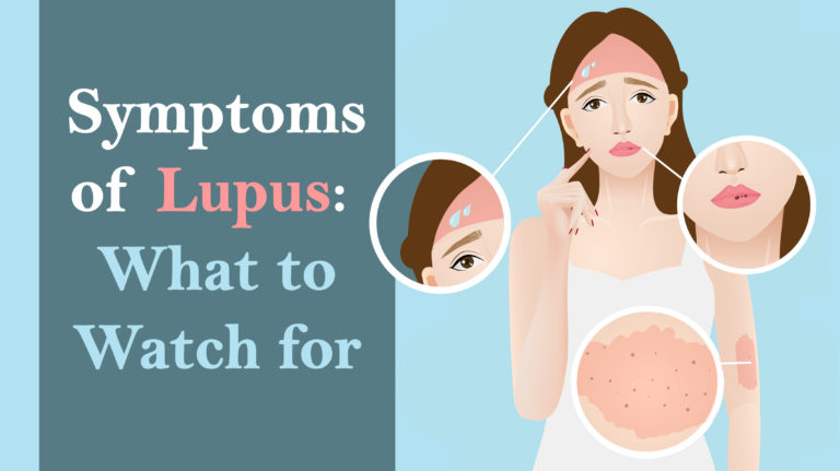 10 Silent Symptoms Of Lupus To Watch For WomenWorking   Lupus Article  768x431 