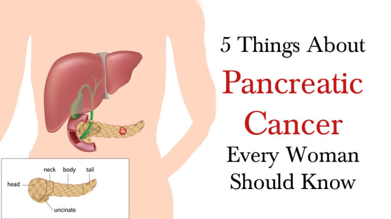 What Every Woman Should Know About Pancreatic Cancer Womenworking 5199