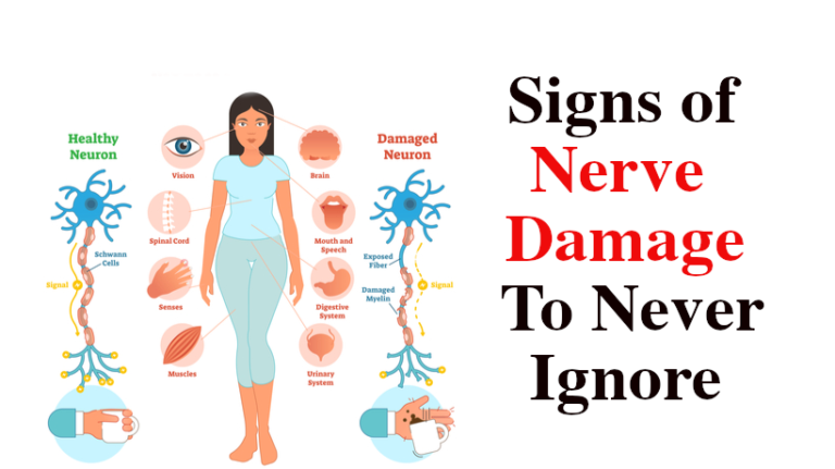 nerve-pain-symptoms-causes-and-treatments