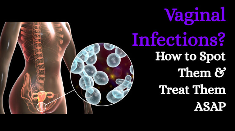 Vaginal Infections How To Spot Them And Treat Them Asap Womenworking