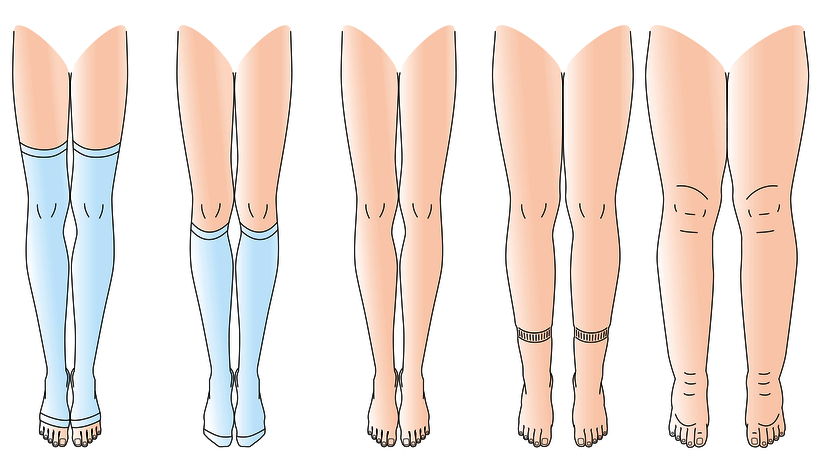 Underlying Causes of Swollen Legs & What to Do - WomenWorking