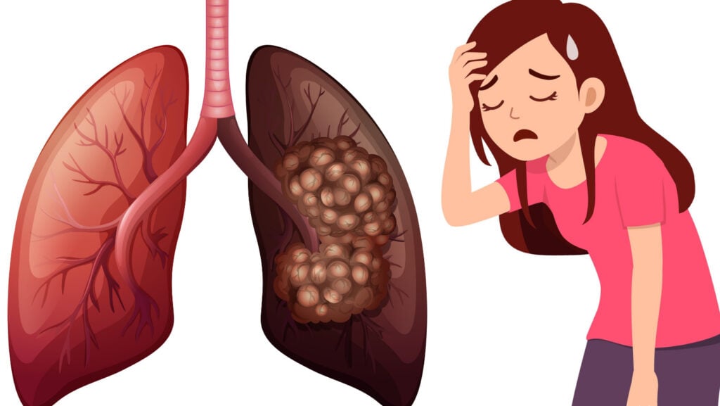 from-hoarseness-to-fatigue-possible-signs-of-lung-cancer-that-are