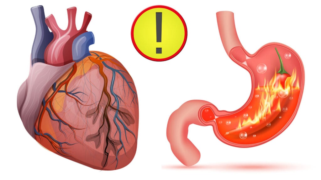 heartburn-vs-heart-attack-how-to-tell-the-difference-womenworking